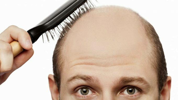 Zijn Schimmelinfecties Verantwoordelijk Voor Haarverlies?
